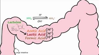 Hepatic Encephalopathy and Lactulose [upl. by Grindlay]