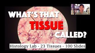 Basic Soft Tissue Pathology amp Bone Tumor Cases Explained by a Sarcoma Pathologist [upl. by Towne]