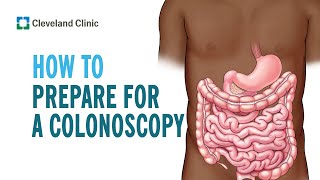 Colonoscopy Preparation  By NUH Colorectal Centre [upl. by Eillil]