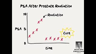 Prostate cancer patients benefit from cuttingedge radiation treatment [upl. by Thorfinn637]