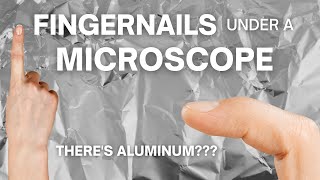 How Do Fingernails Look under a Microscope [upl. by Damalis]