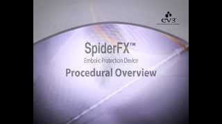 Spider FX [upl. by Uhn]