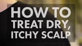 How to Treat a Dry Itchy Scalp  WebMD [upl. by Anuayek]