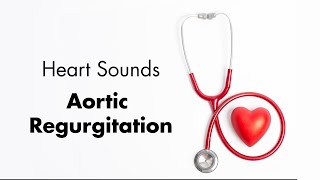 Aortic Regurgitation  Heart Sounds  MEDZCOOL [upl. by Ylrebnik]