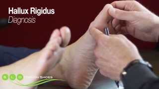 Hallux Rigidus Causes Diagnosis and Treatment [upl. by Latouche]