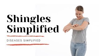 Shingles Simplified [upl. by Aidahs599]