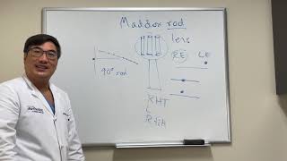 Maddox Rod Testing [upl. by Halihs]