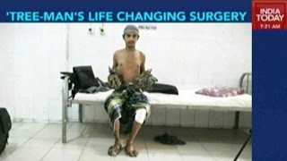 Bangladesh TreeMans Life Changing Surgery [upl. by Sancho]