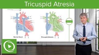 Tricuspid Atresia – Pediatric Cardiology  Lecturio [upl. by Loos499]