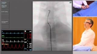 Cardiac Catheterization What You Can Expect [upl. by Htenaj]