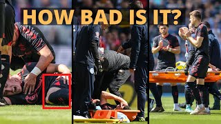 Expert Explains Tino Livramento Injury L Knee amp Timeline Scenarios [upl. by Drahnreb274]