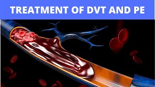 Deep Vein Thrombosis  Overview pathophysiology treatment complications [upl. by Sitruc383]