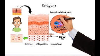 Pharmacology  ACNE TREATMENTS MADE EASY [upl. by Tibbetts]